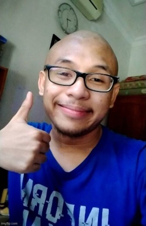 Anh đầu trọc đồng ý nhưng vẫn phải ngầu